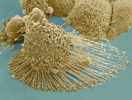 Precisely Targeting Tumors with Cancer-Fighting T Cells